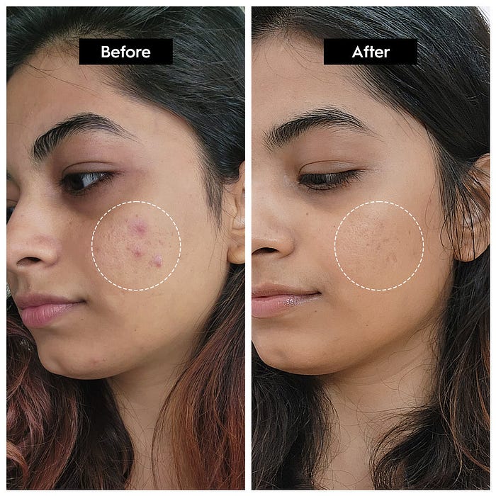 Niacinamide Brightening Face Serum