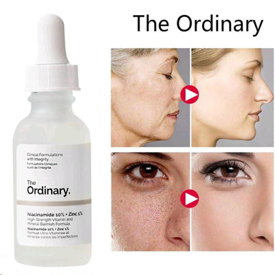 Niacinamide Brightening Face Serum